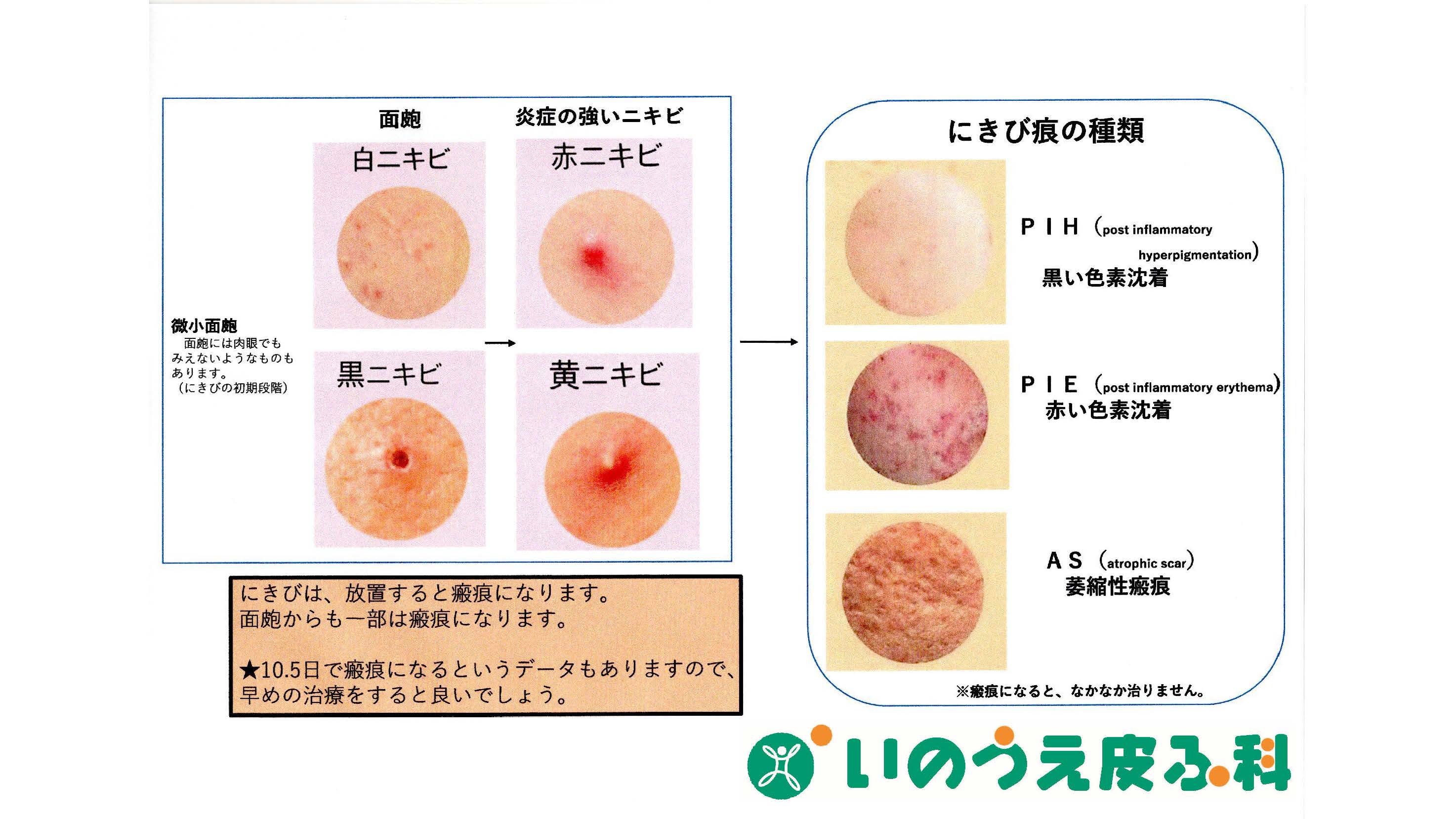 めん ぽう